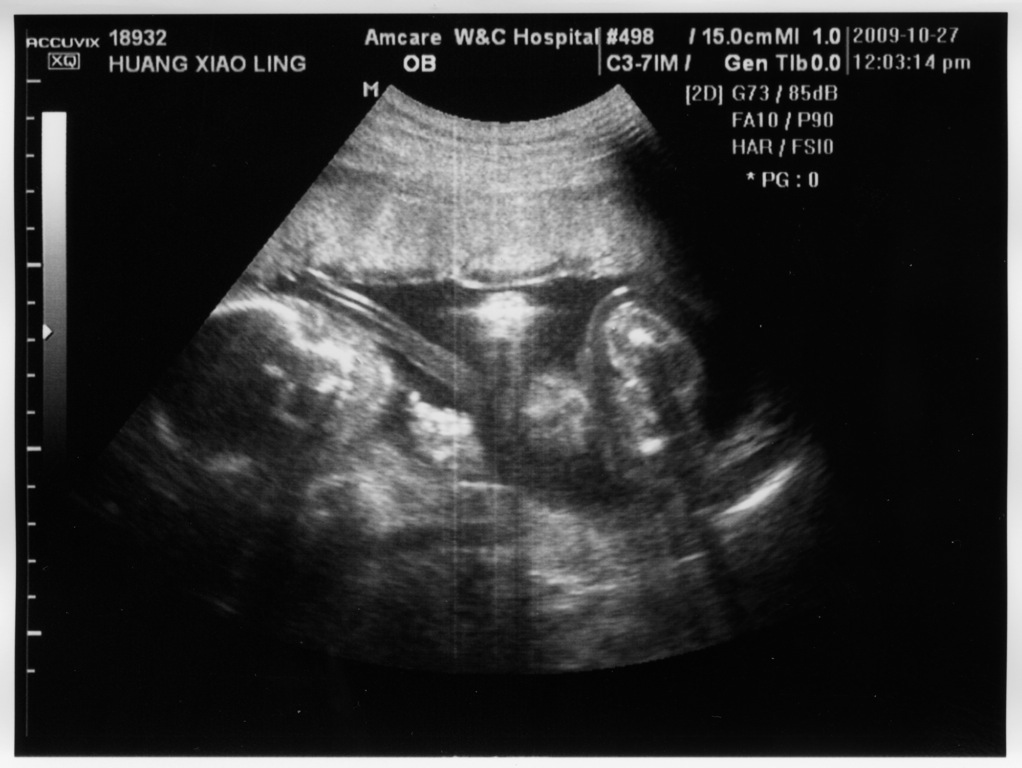 sonograms